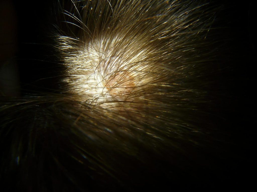 close up of mans scalp