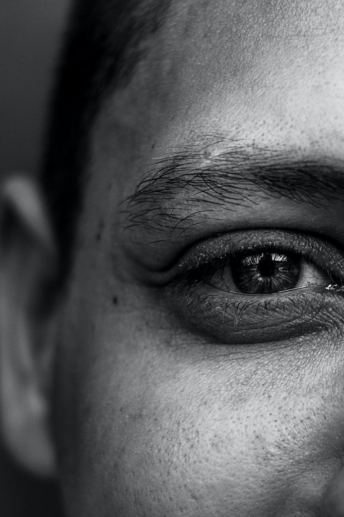 A closeup portrait of a man's single eye with black circle under his eye